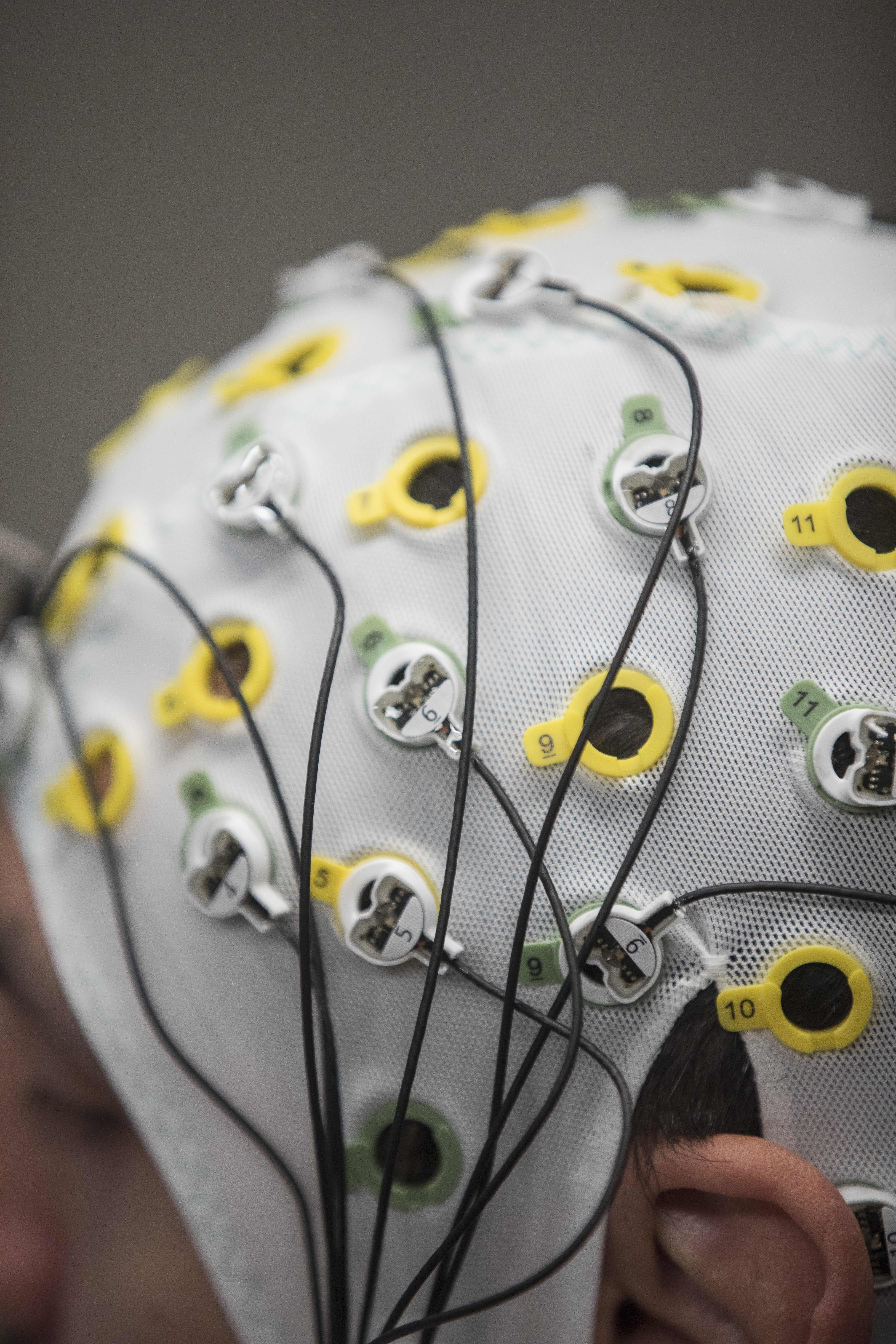 EEG